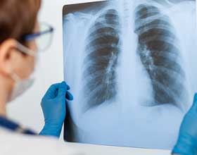 Workers exposed to harsh levels of diesel exhaust: Report  