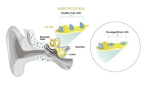 The human ear consists of three parts: the external ear, middle ear, and inner ear. This cross section shows the hair cells that transform the sound vibrations in the fluids of the cochlea into electrical signals that are then relayed via the auditory nerve to the brain.